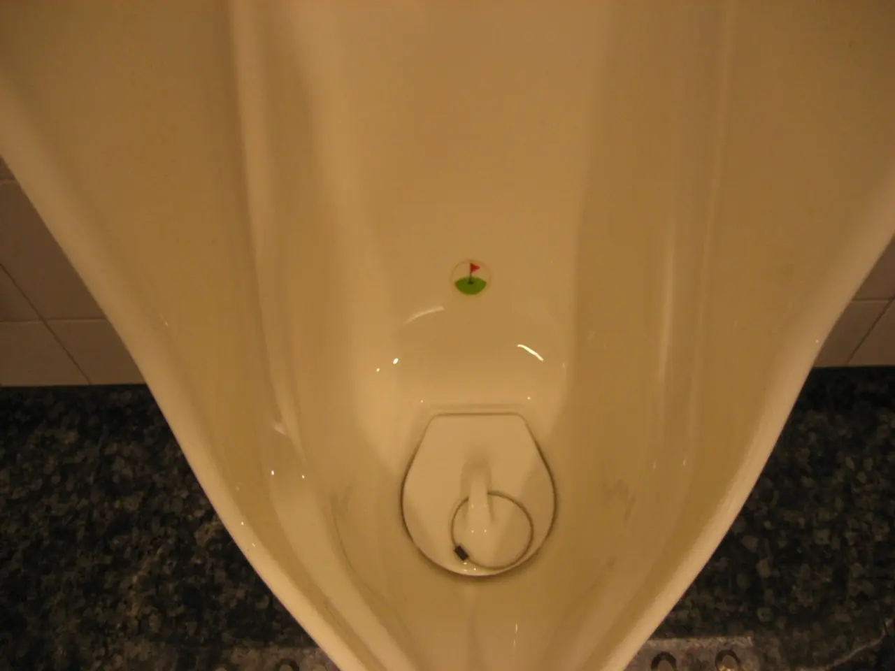 Urinary Bladder Infection: Understanding its Nature, Symptoms, Classes, Remedy, and Identification